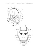 Head Trauma Bandage Cap and Method diagram and image