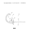 METHODS AND DEVICES FOR INTRAGASTRIC SUPPORT OF FUNCTIONAL OR PROSTHETIC     GASTROINTESTINAL DEVICES diagram and image