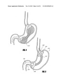 METHODS AND DEVICES FOR INTRAGASTRIC SUPPORT OF FUNCTIONAL OR PROSTHETIC     GASTROINTESTINAL DEVICES diagram and image