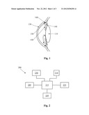 Intraocular Pressure Sensor with External Pressure Compensation diagram and image