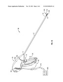 Ultrasound Device for Precise Tissue Sealing and Blade-Less Cutting diagram and image