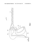 Ultrasound Device for Precise Tissue Sealing and Blade-Less Cutting diagram and image