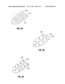 Ultrasound Device for Precise Tissue Sealing and Blade-Less Cutting diagram and image