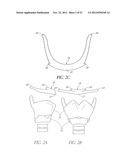 System and method for hyoidplasty diagram and image