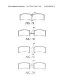 System and method for hyoidplasty diagram and image