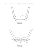 System and method for hyoidplasty diagram and image