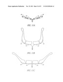 System and method for hyoidplasty diagram and image