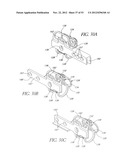 System and method for hyoidplasty diagram and image