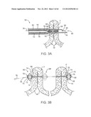 APPARATUS FOR MANIPULATING AND SECURING TISSUE diagram and image