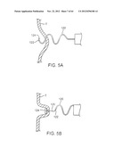 APPARATUS FOR MANIPULATING AND SECURING TISSUE diagram and image