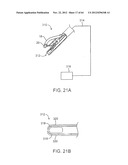 APPARATUS FOR MANIPULATING AND SECURING TISSUE diagram and image