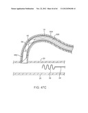 APPARATUS FOR MANIPULATING AND SECURING TISSUE diagram and image