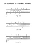 APPARATUS FOR MANIPULATING AND SECURING TISSUE diagram and image