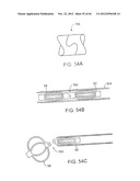 APPARATUS FOR MANIPULATING AND SECURING TISSUE diagram and image