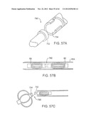 APPARATUS FOR MANIPULATING AND SECURING TISSUE diagram and image