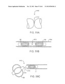 APPARATUS FOR MANIPULATING AND SECURING TISSUE diagram and image