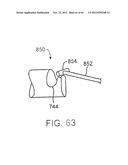 APPARATUS FOR MANIPULATING AND SECURING TISSUE diagram and image