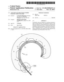 Annuloplasty Ring with Anchors Fixed by Curing Polymer diagram and image