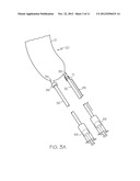 Annuloplasty Ring with Anchors Fixed by Curing Polymer diagram and image