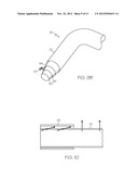 Annuloplasty Ring with Anchors Fixed by Curing Polymer diagram and image