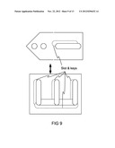 Advanced Intra-spinal Decompression Implant diagram and image