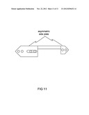 Advanced Intra-spinal Decompression Implant diagram and image