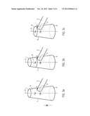 COMPUTER-IMPLEMENTED METHOD FOR DIGITALLY SHORTENING OF A CAP OF A DENTAL     BRIDGE AND A COMPUTER-READABLE MEDIUM diagram and image