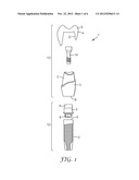 METHOD AND SYSTEM FOR DESIGNING A DENTAL RESTORATION diagram and image