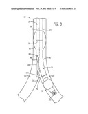 DUAL-LUMEN TRACHEAL TUBE WITH ASSEMBLY PORTION diagram and image