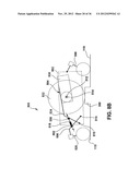 WHEELCHAIR SUSPENSION diagram and image