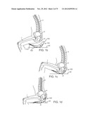 APPARATUS AND SYSTEM FOR DYNAMICALLY CORRECTING POSTURE diagram and image