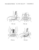 APPARATUS AND SYSTEM FOR DYNAMICALLY CORRECTING POSTURE diagram and image