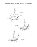 APPARATUS AND SYSTEM FOR DYNAMICALLY CORRECTING POSTURE diagram and image