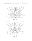 APPARATUS AND SYSTEM FOR DYNAMICALLY CORRECTING POSTURE diagram and image