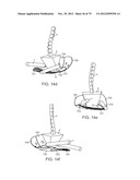 APPARATUS AND SYSTEM FOR DYNAMICALLY CORRECTING POSTURE diagram and image