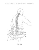 APPARATUS AND SYSTEM FOR DYNAMICALLY CORRECTING POSTURE diagram and image