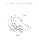 APPARATUS AND SYSTEM FOR DYNAMICALLY CORRECTING POSTURE diagram and image