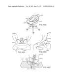 APPARATUS AND SYSTEM FOR DYNAMICALLY CORRECTING POSTURE diagram and image