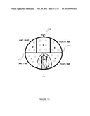 SYSTEM AND METHOD FOR QUANTITATIVE MEASUREMENT OF CARTILAGE HEALTH USING     MRI MAPPING TECHNIQUES diagram and image