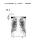 CHEST DIAGNOSTIC SUPPORT INFORMATION GENERATION SYSTEM diagram and image