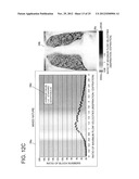 CHEST DIAGNOSTIC SUPPORT INFORMATION GENERATION SYSTEM diagram and image