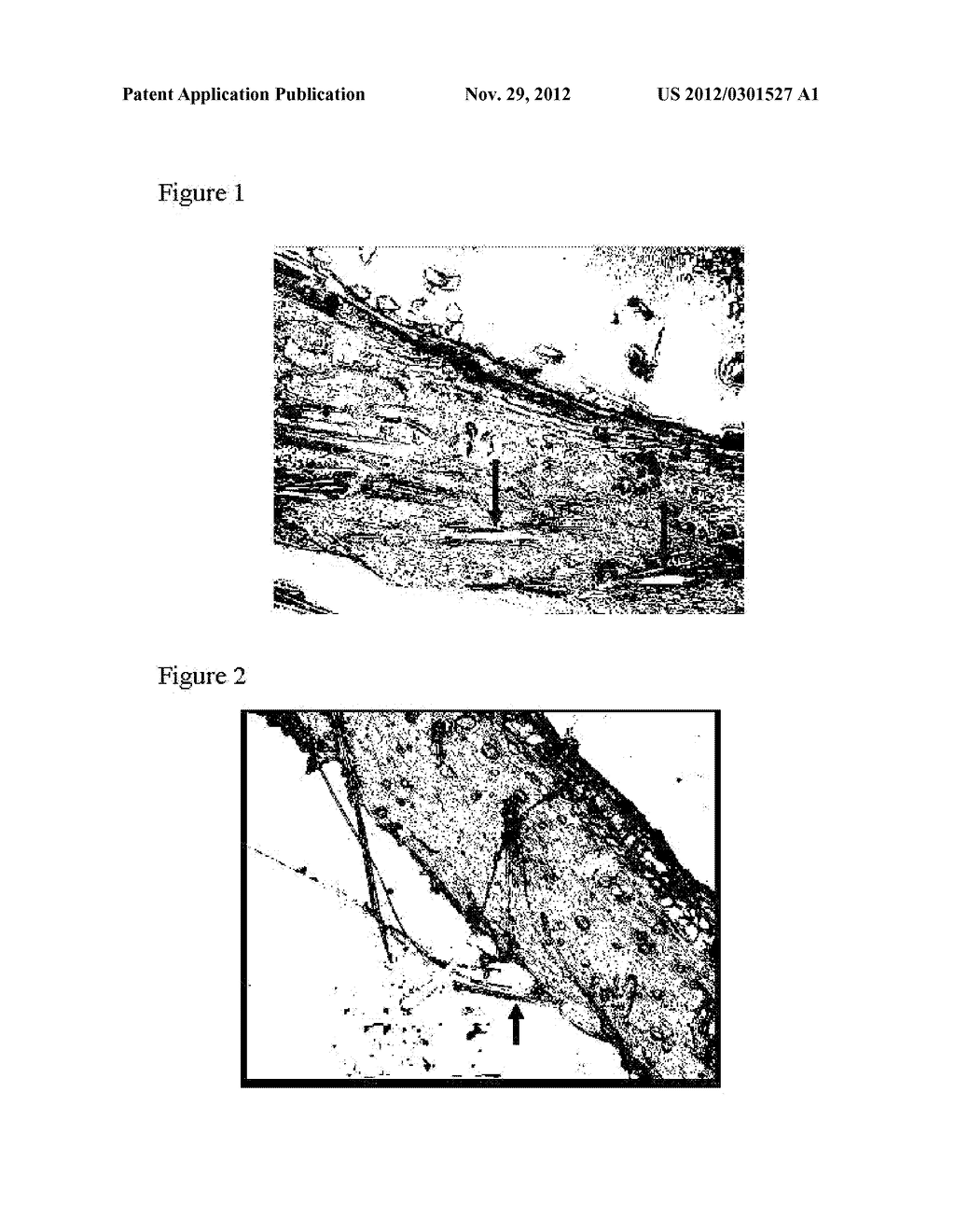 HAIR FOLLICLE TARGETING COMPOSITIONS - diagram, schematic, and image 02