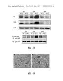 COMPOUNDS AND COMPOSITIONS FOR TREATING NEURONAL DEATH OR NEUROLOGICAL     DYSFUNCTION diagram and image