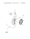 DENTAL TREATMENT AID DEVICE diagram and image