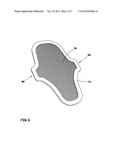 DENTAL TREATMENT AID DEVICE diagram and image