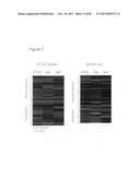 USE OF EMT GENE SIGNATURES IN CANCER DRUG DISCOVERY, DIAGNOSTICS, AND     TREATMENT diagram and image