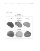 USE OF EMT GENE SIGNATURES IN CANCER DRUG DISCOVERY, DIAGNOSTICS, AND     TREATMENT diagram and image