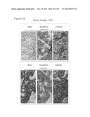 USE OF EMT GENE SIGNATURES IN CANCER DRUG DISCOVERY, DIAGNOSTICS, AND     TREATMENT diagram and image