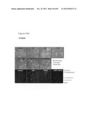 USE OF EMT GENE SIGNATURES IN CANCER DRUG DISCOVERY, DIAGNOSTICS, AND     TREATMENT diagram and image