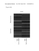 USE OF EMT GENE SIGNATURES IN CANCER DRUG DISCOVERY, DIAGNOSTICS, AND     TREATMENT diagram and image